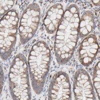Anti-SYT16 antibody produced in rabbit HPA004199-100UL
