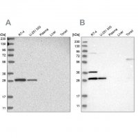 Anti-TACO1 antibody produced in rabbit HPA024294-100UL