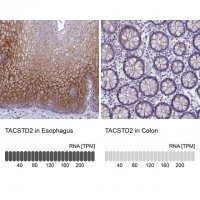 Anti-TACSTD2 antibody produced in rabbit