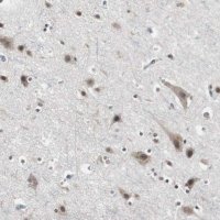 Anti-TAF7 antibody produced in rabbit HPA006429-100UL