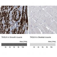 Anti-TAGLN antibody produced in rabbit 