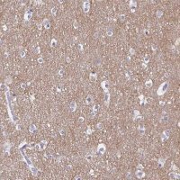 Anti-TAGLN3 antibody produced in rabbit
