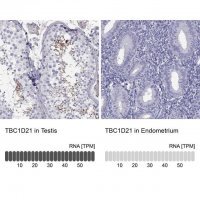 Anti-TBC1D21 antibody produced in rabbit