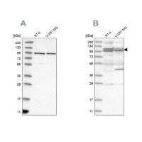 Anti-TBC1D5 antibody produced in rabbit 
