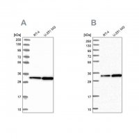 Anti-TBCB antibody produced in rabbit 