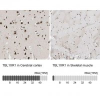 Anti-TBL1XR1 antibody produced in rabbit 