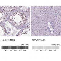 Anti-TBPL1 antibody produced in rabbit