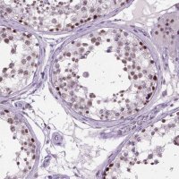 Anti-TBPL1 antibody produced in rabbit