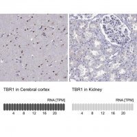 Anti-TBR1 