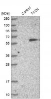 Anti-TC2N antibody produced in rabbit HPA027549-100UL