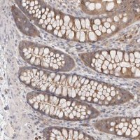 Anti-TC2N antibody produced in rabbit HPA027549-100UL