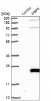 Anti-TCEAL9 antibody produced in rabbit 