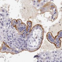 Anti-TCEANC antibody produced in rabbit