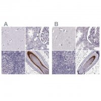 Anti-TCHHL1 antibody produced in rabbit 