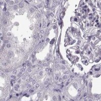 Anti-TCHHL1 antibody produced in rabbit 