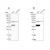 Anti-TCP1 antibody produced in rabbit 