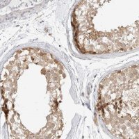 Anti-TCP1 antibody produced in rabbit 