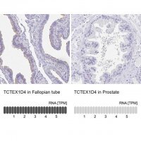Anti-TCTEX1D4 antibody produced in rabbit 