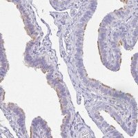 Anti-TCTEX1D4 antibody produced in rabbit 