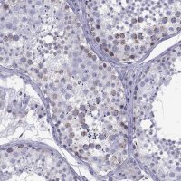 Anti-TDRD1 antibody produced in rabbit 