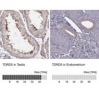 Anti-TDRD5 antibody produced in rabbit 