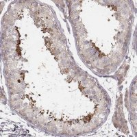 Anti-TDRD5 antibody produced in rabbit 