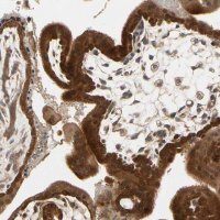 Anti-TDRP antibody produced in rabbit HPA008462-100UL