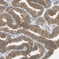 Anti-TDRP antibody produced in rabbit HPA008462-100UL