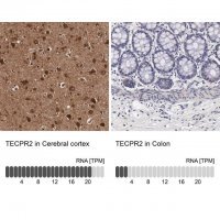 Anti-TECPR2 antibody produced in rabbit 