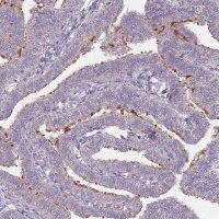 Anti-TEKT4 antibody produced in rabbit 