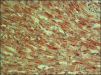 Anti-Tensin 1 antibody produced in rabbit 