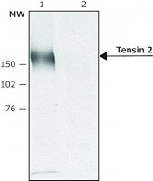 Anti-Tensin 2 (C-terminal) antibody produced in rabbit 