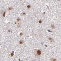 Anti-TERF2 antibody produced in rabbit 