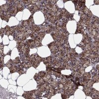 Anti-TESC antibody produced in rabbit