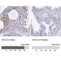 Anti-TEX12 antibody produced in rabbit