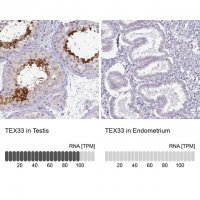Anti-TEX33 antibody produced in rabbit HPA005998-100UL