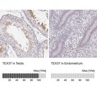 Anti-TEX37 antibody produced in rabbit 