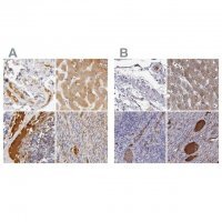 Anti-TF antibody produced in rabbit 