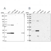Anti-TFAM antibody produced in rabbit 