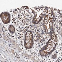 Anti-TFB1M antibody produced in rabbit 