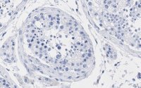Anti-TFE3 Antibody, clone 1G5 ZooMAb� Rabbit Monoclonal 