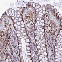 Anti-TGDS antibody produced in rabbit