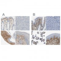 Anti-TGFBI antibody produced in rabbit 