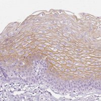 Anti-TGM1 antibody produced in rabbit 