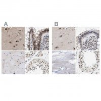 Anti-THOC1 antibody produced in rabbit