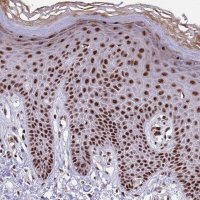 Anti-THOC2 antibody produced in rabbit 