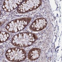 Anti-THOC3 antibody produced in rabbit