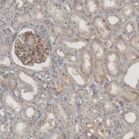 Anti-THSD7A antibody produced in rabbit 
