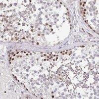 Anti-TIMELESS antibody produced in rabbit