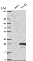 Anti-TIMM22 antibody produced in rabbit